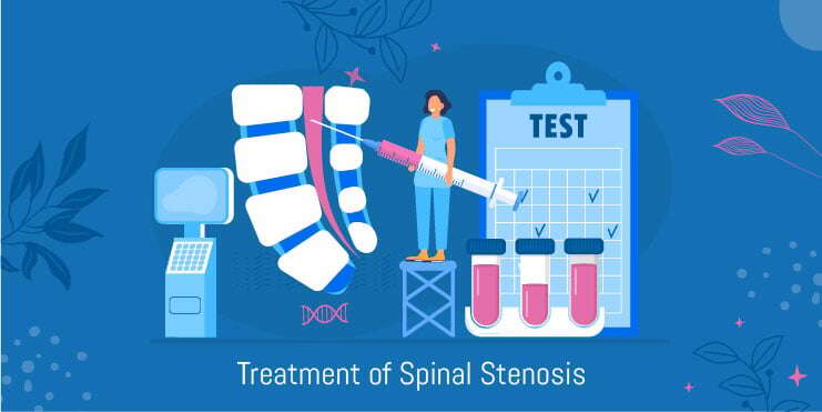 spinal stenosis treament