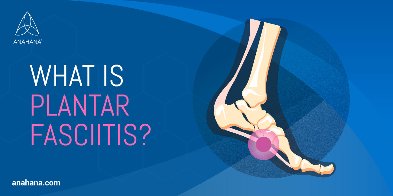 What is Plantar fasciitis