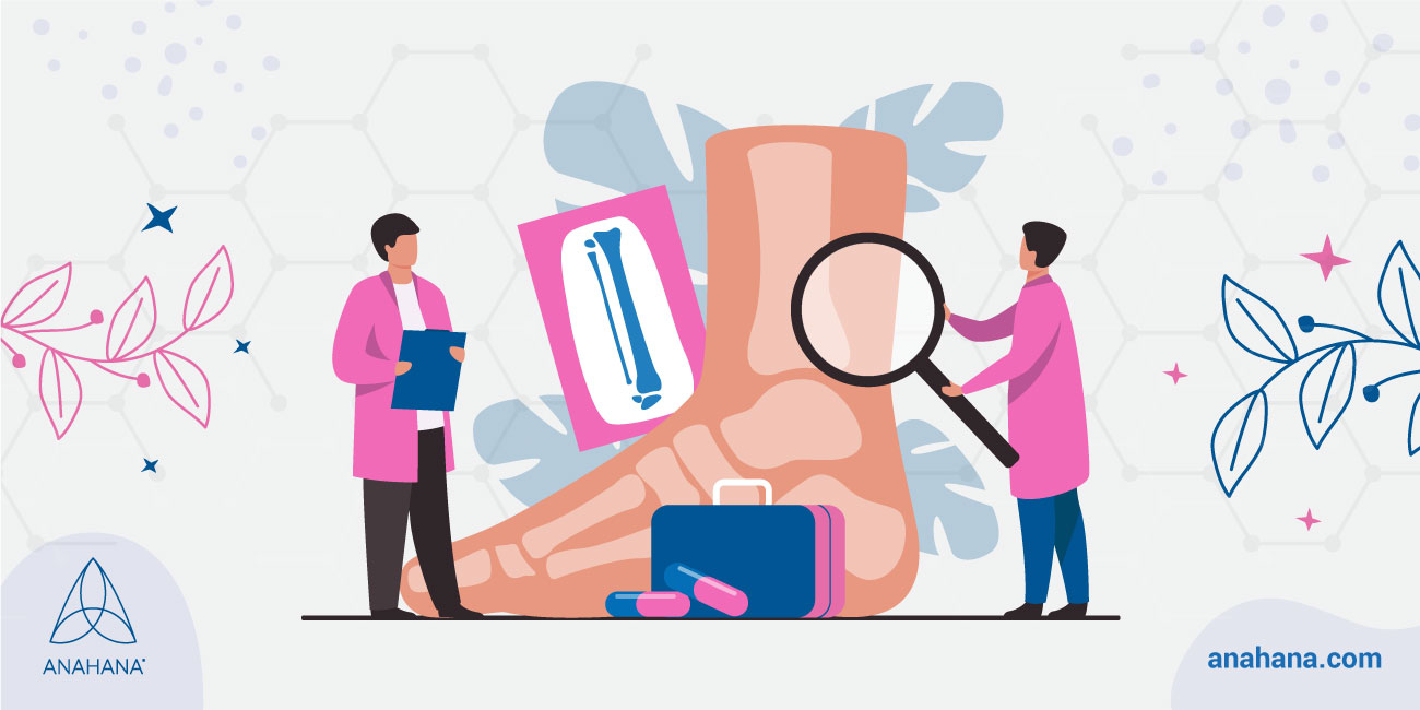 perguntas frequentes sobre a fascite plantar