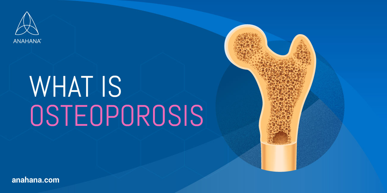 Che cos'è l'osteoporosi