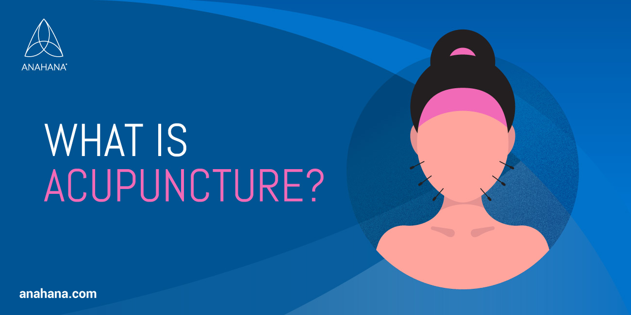 Qu'est-ce que l'acupuncture ?