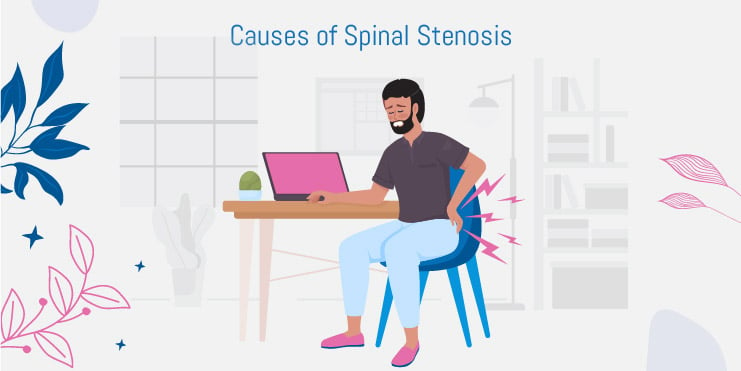 orsaker till spinal stenos