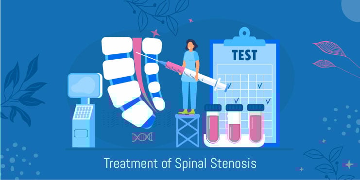 traitement de la sténose spinale