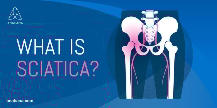 what is sciatica