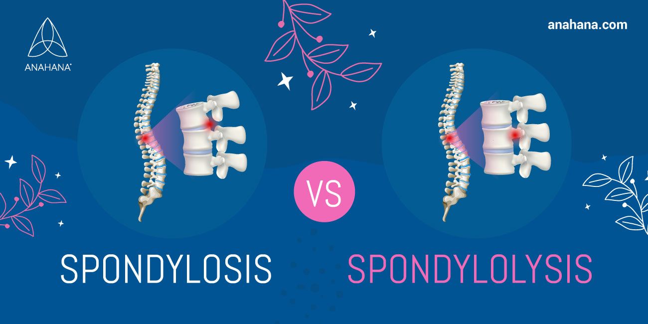 qué es la espondilosis vs espondilolisis