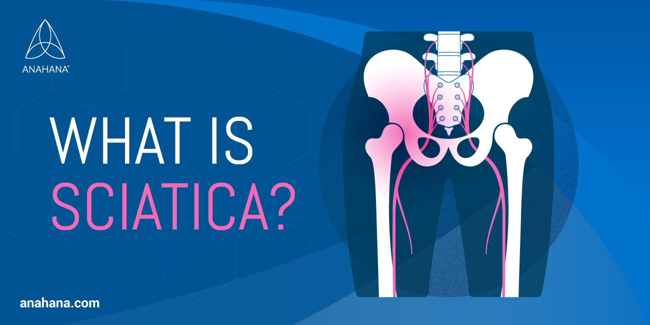 Sciatica - Symptoms and causes - Mayo Clinic