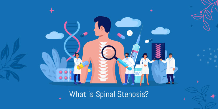 what is spinal stenosis, the subject explained