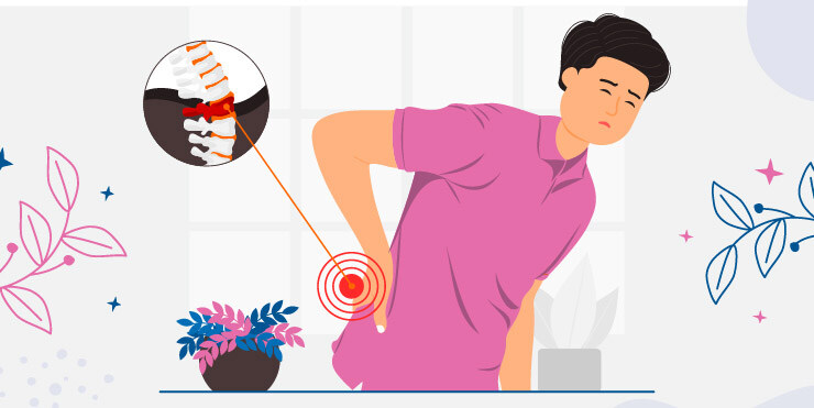 domande sulla stenosi spinale