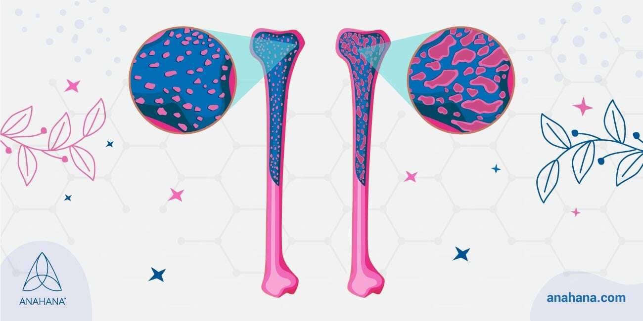 different treatments for osteoporosis